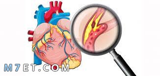 The largest artery in the body